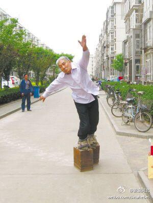 Pakai Sepatu Besi 400 Kg, si Kakek Sembuh dari Sakit Pinggang