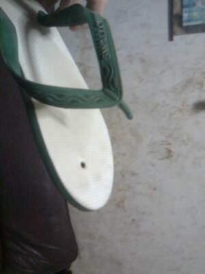 Pertolongan Pertama Pada Sandal Jepit