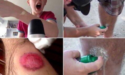 Tren konyol remaja barat, semprot aerosol deodoran ke kaki hingga luka :hammer