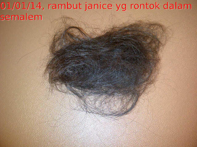 PRAY FOR JANICE penderita tumor otak ATRT yang langka!