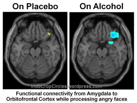Balasan Dari Cara Alkohol Mempengaruhi Sistem Saraf Dan Ganggu Kemampuan Otak Kaskus