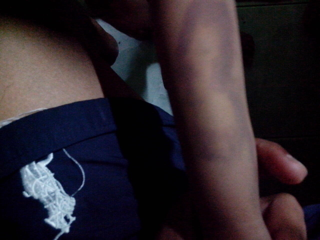TENTANG HEMOPHILIA & APAKAH HEMOPILIA DAPAT DI SEMBUHKAN