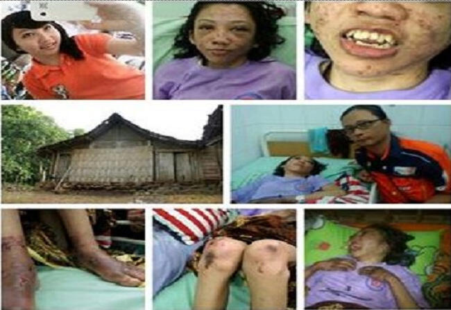 &#91;with PIC&#93; Ini Penjelasan KJRI Hong Kong Soal Penyiksaan TKI Erwiana 