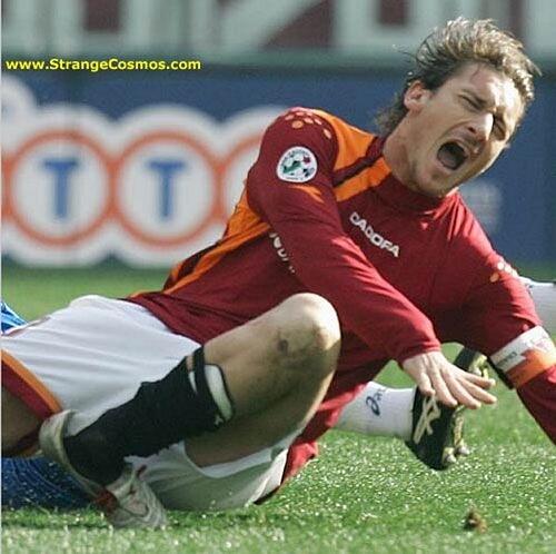 Moment-Moment 'Ouch' Ini Buat Kamu Ngilu, Berani Lihat?