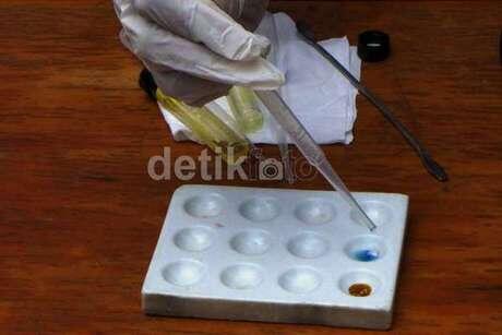 3 Cerita tentang Sosok Wanita Muda Penyimpan Sabu Rp 369 Juta di Anusnya