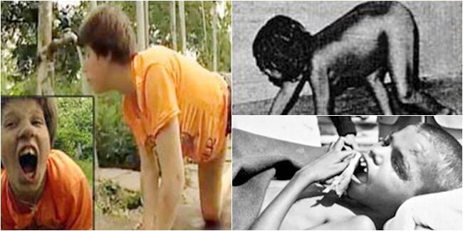 7 Manusia Ini Dibesarkan Oleh Hewan Dan Bertingkah Laku Bak Hewan Pula