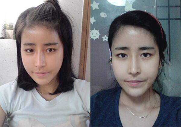  HOME &raquo; RELATIONSHIP &raquo; LOVE Dokter Bedah Plastik Korea Jatuh Cinta Pada Pasiennya Sen