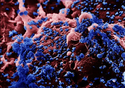 6 Virus Paling Mematikan Bagi Manusia