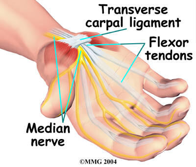 Jari tangan sering kesemutan waktu sepedaan (Carpal Tunnel Syndrome)