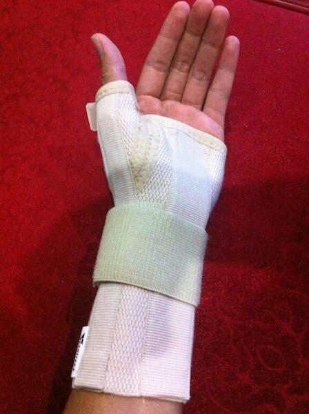 Jari tangan sering kesemutan waktu sepedaan (Carpal Tunnel Syndrome)