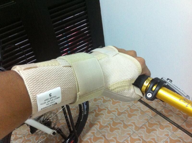 Jari tangan sering kesemutan waktu sepedaan (Carpal Tunnel Syndrome)