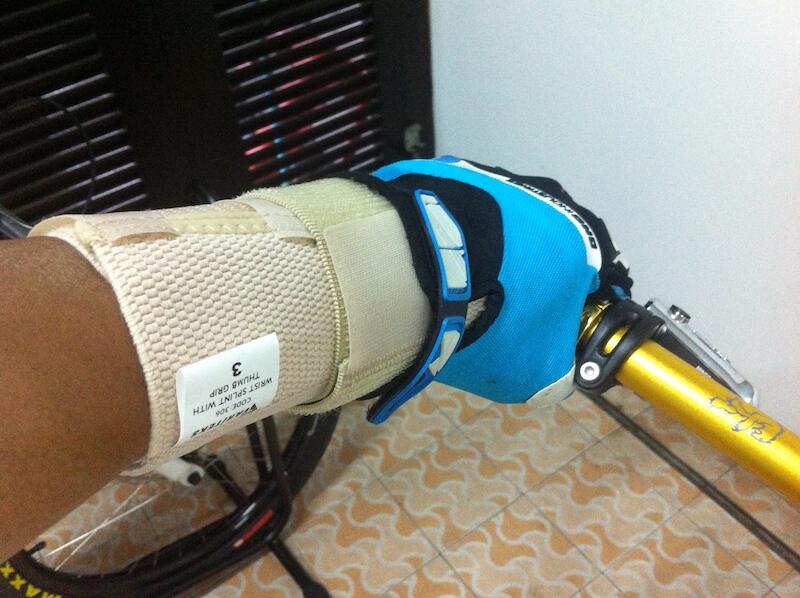 Jari tangan sering kesemutan waktu sepedaan (Carpal Tunnel Syndrome)
