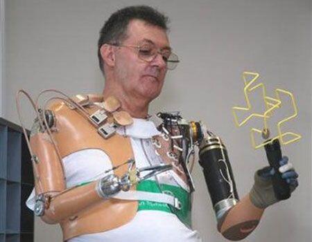 Kehidupan nyata mirip-mirip " CYBORG " ,