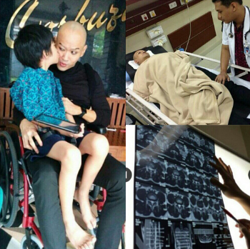 Deddy Corbuzier lumpuh gara gara diet OCD ?