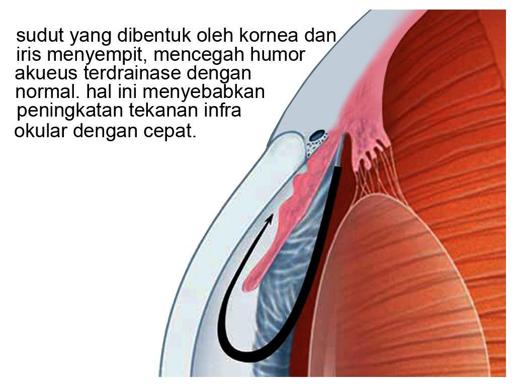 Mitos Penyakit Mata yang Jarang Diketahui Manusia