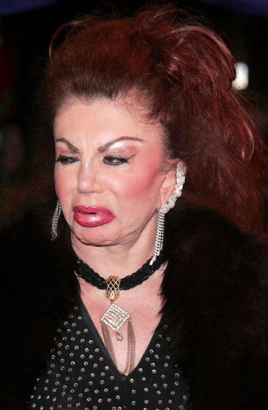 Jackie Stallone, Korban Kecanduan Operasi Plastik