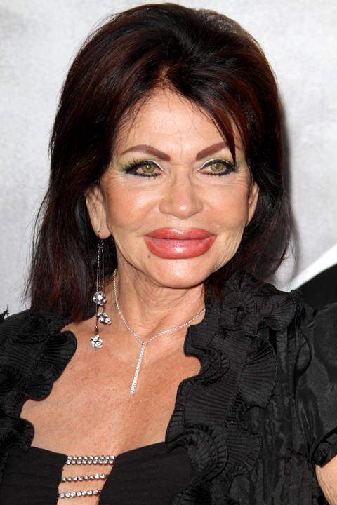Jackie Stallone, Korban Kecanduan Operasi Plastik