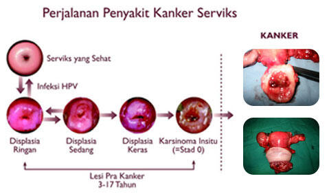 PUSAT PENJUALAN TISU DOUBLE MAJAKANI, LADYFEM, ORIS BREAST TERPERCAYA MID 0036236