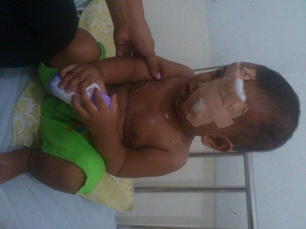 &#91;Penyerahan Dana&#93; Syahrizan Penderita Kanker Mata (Hydrocephalus)