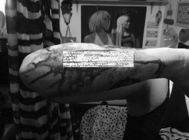 Tatto Nama Co Pada Lengan Ce Dikuliti oleh Ce-nya Sendiri, Kemudian Dikirim ke Co-nya