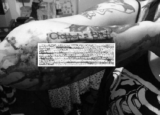 Tatto Nama Co Pada Lengan Ce Dikuliti oleh Ce-nya Sendiri, Kemudian Dikirim ke Co-nya