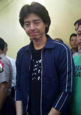 Perubahan Wajah Before &amp; After Menggunakan Narkoba