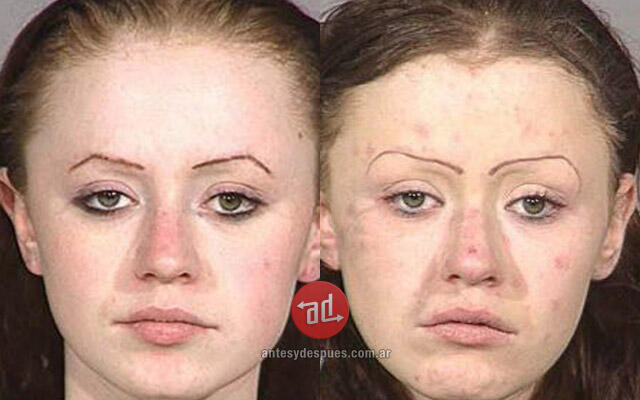 Perubahan Wajah Before &amp; After Menggunakan Narkoba