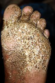 ampe merinding melulu