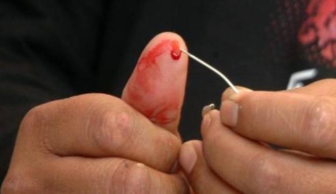 Pertolongan pertama pada penderita stroke ! &#91;this may help&#93;