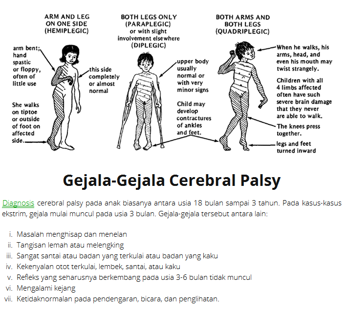 Share..Autis dengan Cerebral Palsy itu beda gan..