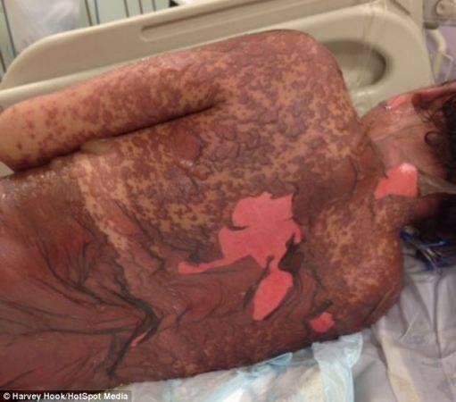 [HOT] Hati2 gan salah minum obat Fatal [PICT]