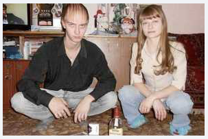 koleksi SISA SISA RAMBUT yang UNIK di kepala yang BOTAK karena RONTOK