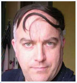 koleksi SISA SISA RAMBUT yang UNIK di kepala yang BOTAK karena RONTOK