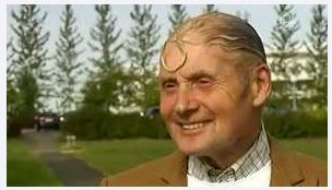 koleksi SISA SISA RAMBUT yang UNIK di kepala yang BOTAK karena RONTOK