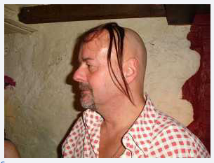 koleksi SISA SISA RAMBUT yang UNIK di kepala yang BOTAK karena RONTOK