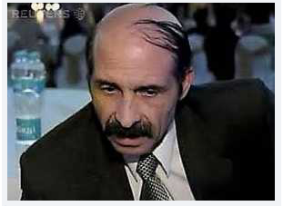 koleksi SISA SISA RAMBUT yang UNIK di kepala yang BOTAK karena RONTOK