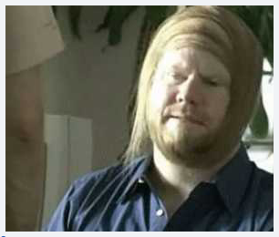 koleksi SISA SISA RAMBUT yang UNIK di kepala yang BOTAK karena RONTOK