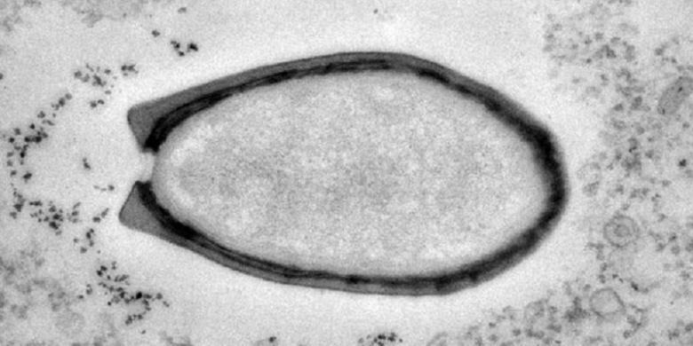 Tidur Selama 30.000 Tahun, Sebuah Virus Kuno Bangkit Kembali