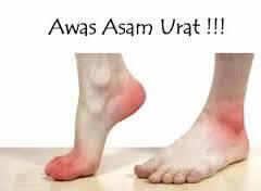 Cara Minum Kopi yang Benar Sesuai Manfaat Kesehatan