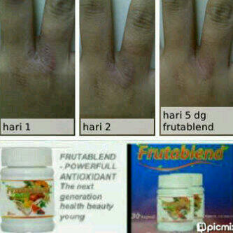 Frutablend BANDUNG murah meriah terpercaya (authorized distributor)