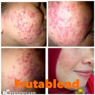 Frutablend BANDUNG murah meriah terpercaya (authorized distributor)