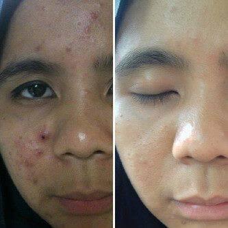 Frutablend BANDUNG murah meriah terpercaya (authorized distributor)