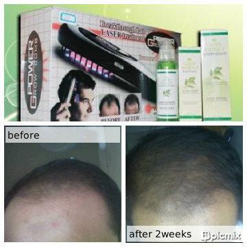 Green angelica penumbuh rambut alami tapa efek samping
