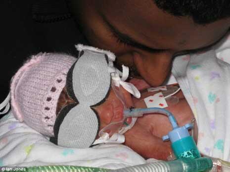Bayi Ajaib, Lahir Dari Ibu Yang Sudah Meninggal 2 Hari