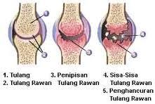 Jual Glucosamine/ Glukosamin Terbaik Harga Grosir Triple Strength Chondroitin, MSM