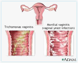  &#91;Women Only&#93; Ini 5 Penyebab Vagina Berbau Tidak Sedap, Coba Di Cek Ya.. &#91;BB dikit&#93;