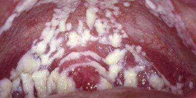  &#91;Women Only&#93; Ini 5 Penyebab Vagina Berbau Tidak Sedap, Coba Di Cek Ya.. &#91;BB dikit&#93;