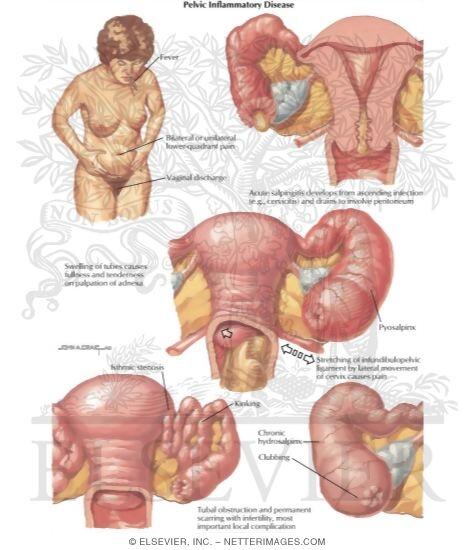  &#91;Women Only&#93; Ini 5 Penyebab Vagina Berbau Tidak Sedap, Coba Di Cek Ya.. &#91;BB dikit&#93;