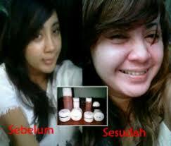 <b>Cream Syahrini - Baby Pink Cream ( Racikan Dokter Linda Baby )</b>