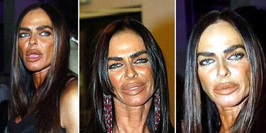 Hiy, Wajah-Wajah Seram Akibat Operasi Plastik!